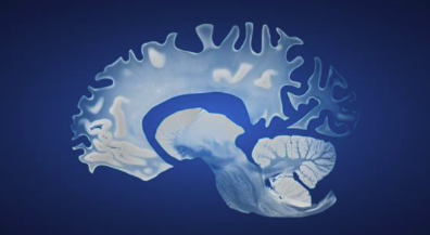 Beyond Brain Fog: How Neuropeptides Are Reshaping Brain Health in Clinical Practice